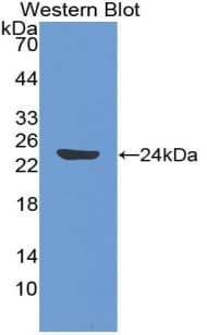 TEK / TIE2 Antibody (aa286-465)