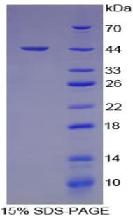 Human HFE2 / Hemojuvelin Protein (Recombinant His-T7)