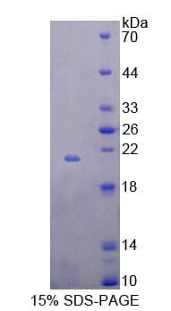 Rat BTLA / CD272 Protein (Recombinant His-T7)