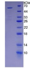 Human KIR2DS2 / CD158j Protein (Recombinant His-GST)