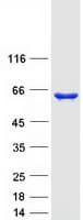 Human ASNS Protein (Recombinant Myc-DDK (Flag))