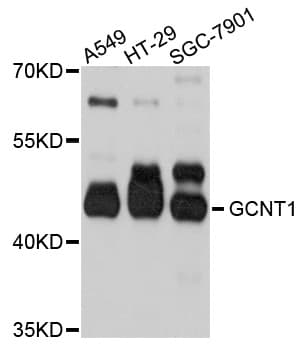 GCNT1 / C2GNT Antibody