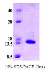Human CRABP2 Protein (Recombinant)