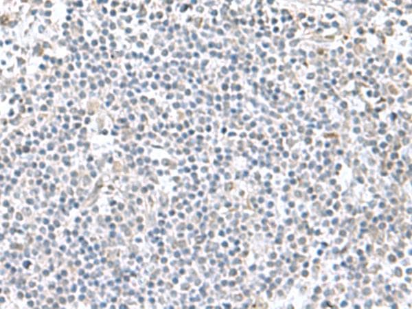 PAM16 Antibody