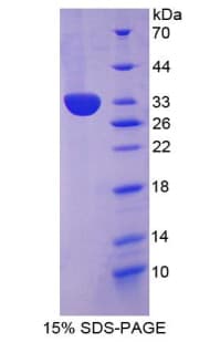 Mouse COL1A2 / Collagen I Alpha 2 Protein (Recombinant His-T7)