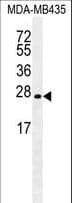 LIN28A / LIN28 Antibody
