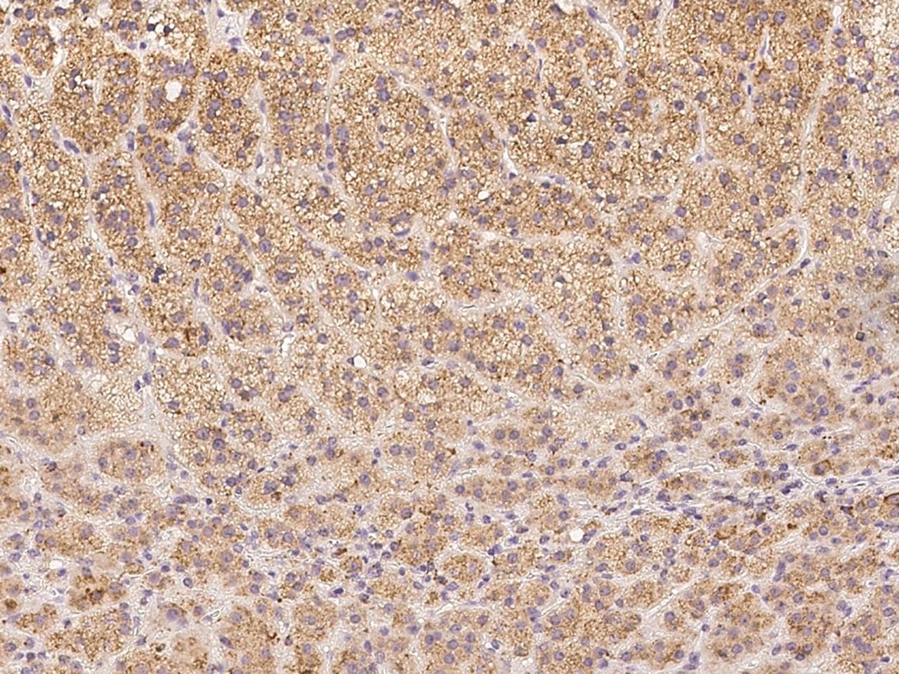 Polyclonal Rabbit anti-Human HEXA Antibody (IHC)