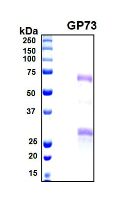 Human GOLM1 / GP73 / GOLPH2 Protein (Recombinant 6His, N-terminus)