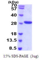 Human CFD / Factor D / Adipsin Protein (Recombinant His)
