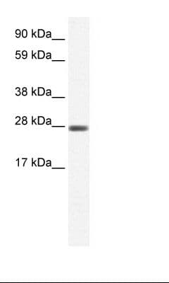 Polyclonal Rabbit anti-Human CLIC1 / NCC27 Antibody (C-Terminus, WB)
