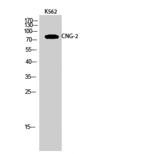 CNGA2 Antibody (360-440 aa, Internal)