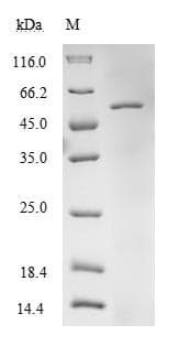 Human EFTU / TUFM Protein (Recombinant 6His, N-terminus)