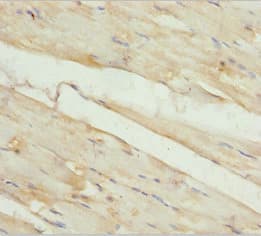 Polyclonal Rabbit anti-Human KBTBD3 Antibody (IHC)