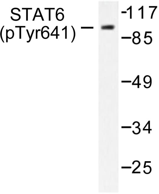 STAT6 Antibody (phospho-Tyr641)