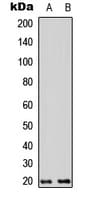 Polyclonal Rabbit anti-Human TNFAIP8L2 Antibody (Internal, WB)