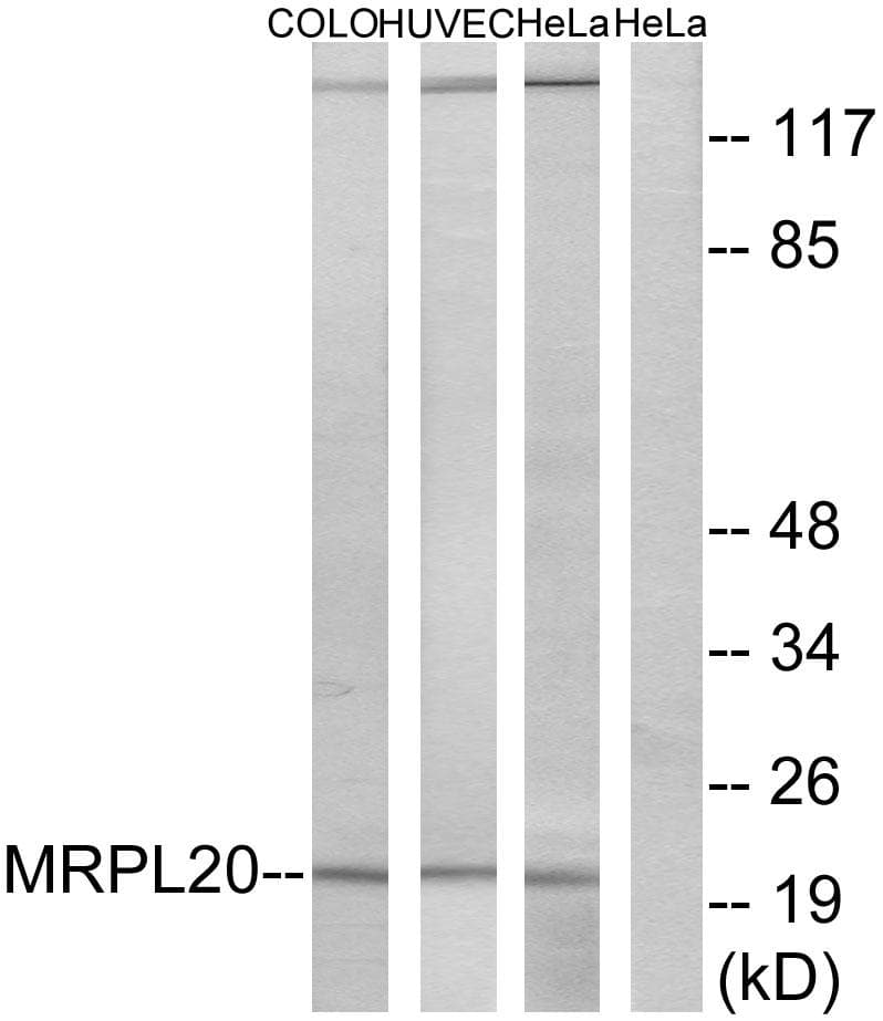MRPL20 Antibody