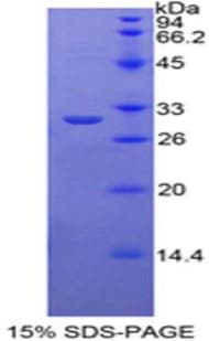 Human TRADD Protein (Recombinant His-T7)