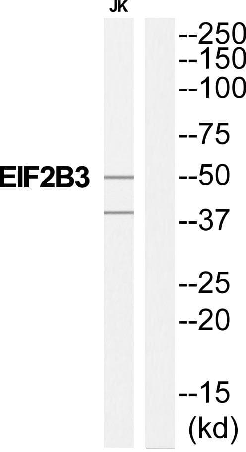 Polyclonal Rabbit anti-Human EIF2B3 Antibody (WB)