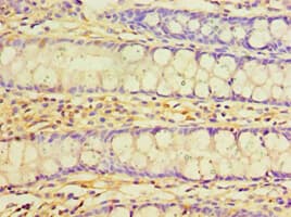 IHC-plus™ TNNC2 Antibody (aa1-160)