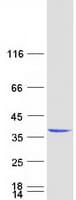 Human EXOSC3 Protein (Recombinant Myc-DDK (Flag))