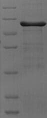 Mouse ADH7 Protein (Recombinant 6His-SUMO, N-terminus)