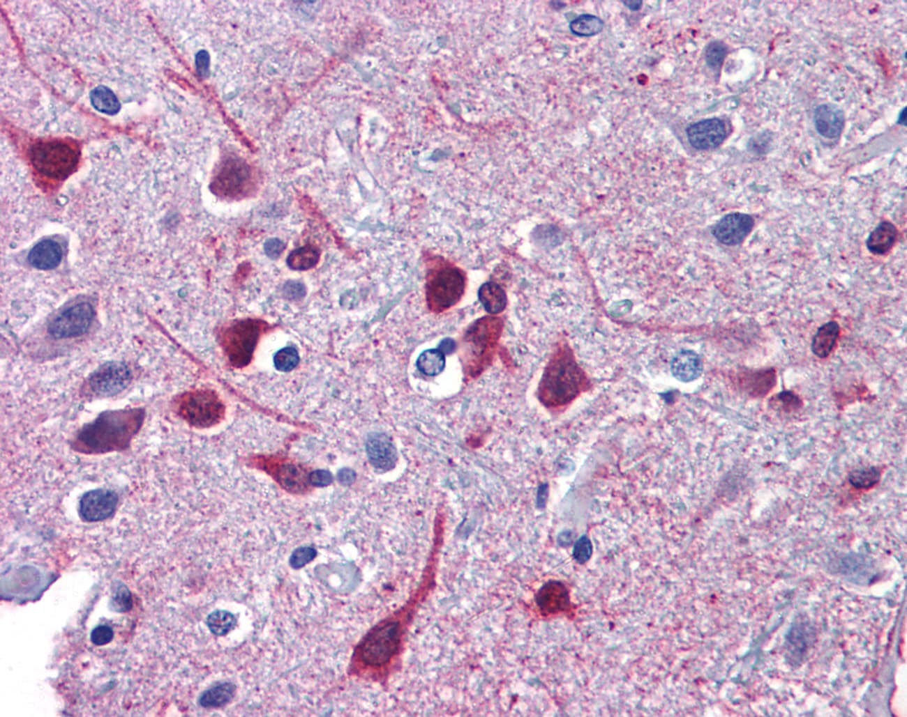 Polyclonal Rabbit anti-Human RARB / RAR Beta Antibody (C-Terminus, IHC, WB)