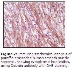 DES / Desmin Antibody (clone 10H7D2)