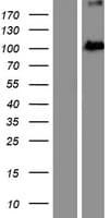 EXOC2 / SEC5 Protein (Over-Expression Lysate Myc-DDK (Flag))