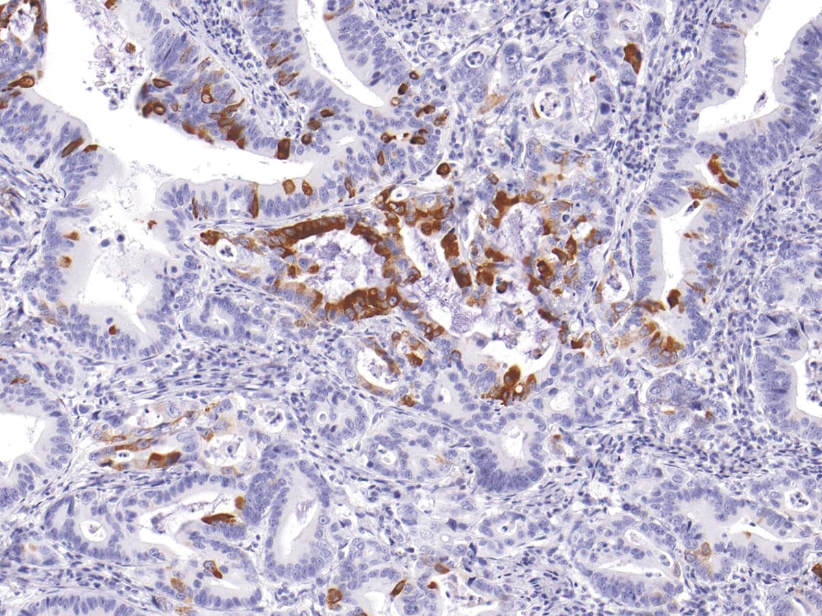 MUC5AC Antibody (Concentrated)