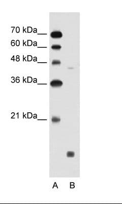 S1PR5 / EDG8 / S1P5 Antibody (N-Terminus)