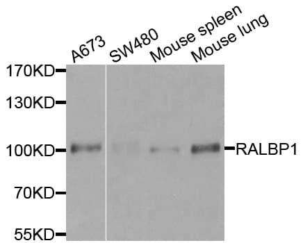 Polyclonal Rabbit anti-Human RIP1 / RALBP1 Antibody (IHC, WB)