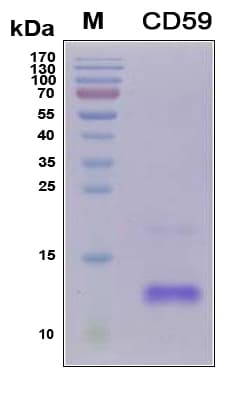 Human CD59 Protein (Recombinant 6His, N-terminus)