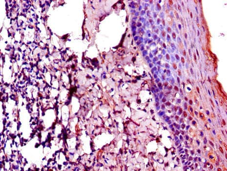 ERIC-1 / TACC3 Antibody