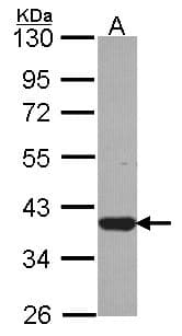 LZTFL1 Antibody (aa1-269)