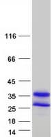 Human DUT / DUTPase Protein (Recombinant Myc-DDK (Flag))