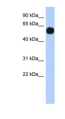 Polyclonal Rabbit anti-Human MPP7 Antibody (N-Terminus, WB)