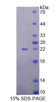 Human MEF2A / MEF2 Protein (Recombinant His-T7)