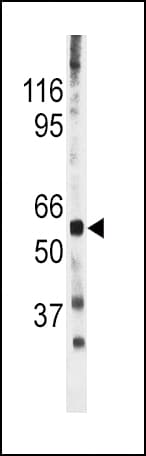 CDC25A Antibody (phospho-Ser278)