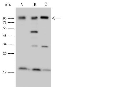 NCAPH / CAP-H Antibody