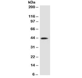 AMACR / P504S Antibody (clone 2MACR-1)