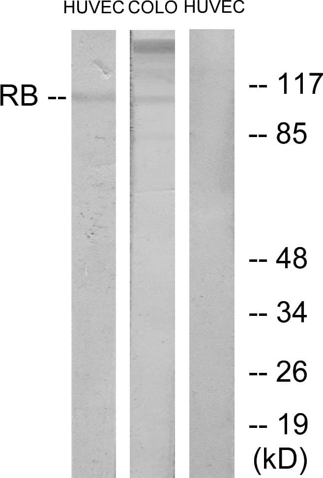 RB1 / Retinoblastoma / RB Antibody (aa761-810)