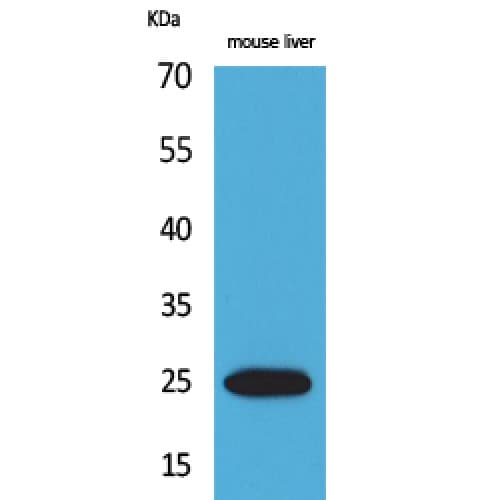 CRP / C-Reactive Protein Antibody (101-150 aa, Internal)