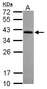 RFPL2 Antibody