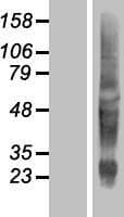 KRTAP10-11 Protein (Over-Expression Lysate Myc-DDK (Flag))