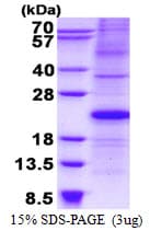 Human CDKN1A / WAF1 / p21 Protein (Recombinant His)