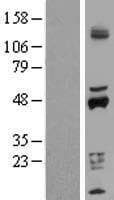 CYP2D6 Protein (Over-Expression Lysate Myc-DDK (Flag))