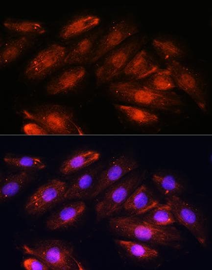 OTUB1 / OTU1 Antibody