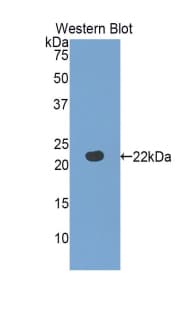 FBLN5 / Fibulin 5 Antibody (aa277-448)