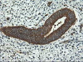 PFKP Antibody (clone OTI2F2, Carrier-free)