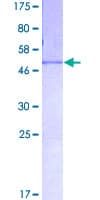 Human FGA / Fibrinogen Alpha Protein (Recombinant GST)